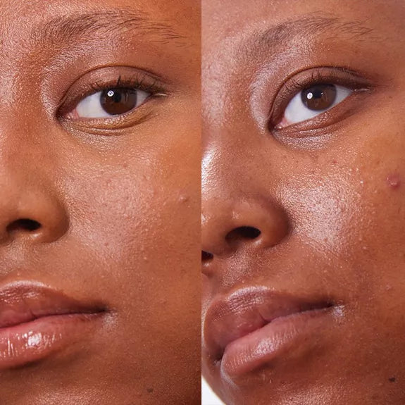 PURE U.  Concealer Balm 7 | 5g