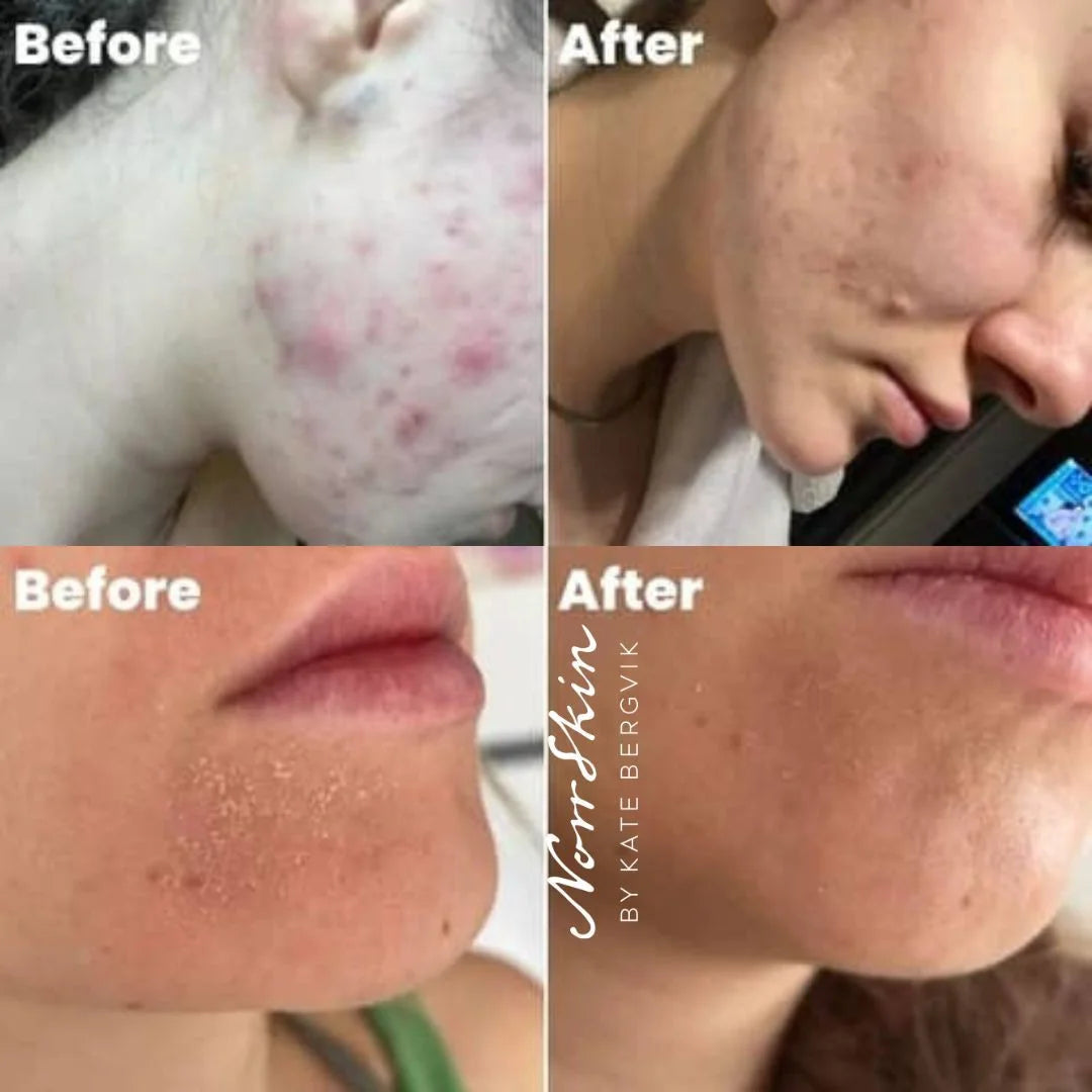 NORRSKIN  Award Winning Natural Cleansing Foam - ECO Natural Face Cleanser | 150ml