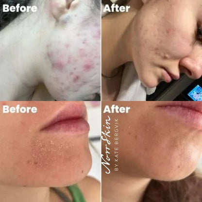 NORRSKIN  Award Winning Natural Cleansing Foam - ECO Natural Face Cleanser | 150ml